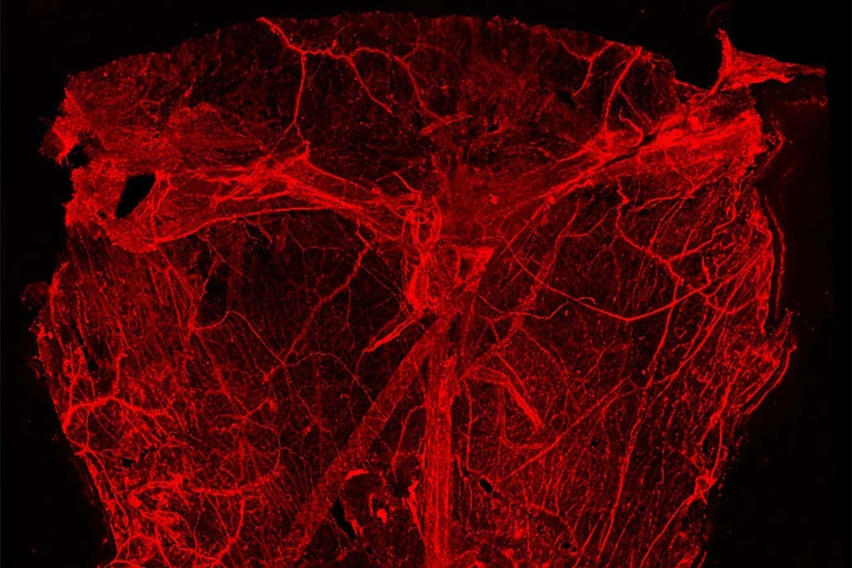 De blauwe buisjes: onbekend netwerk in brein ontdekt
